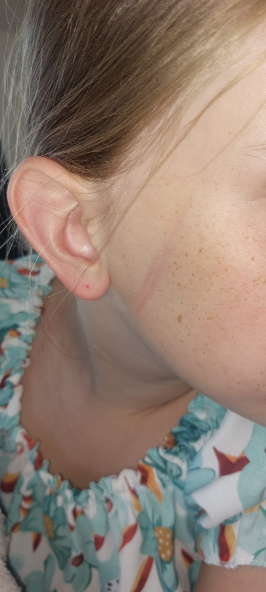 Leer hoe je een basis EHBO-handeling uitvoert foto 1